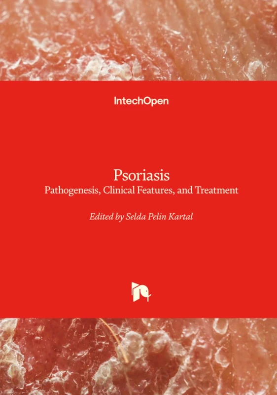 Psoriasis - Pathogenesis, Clinical Features, and Treatment