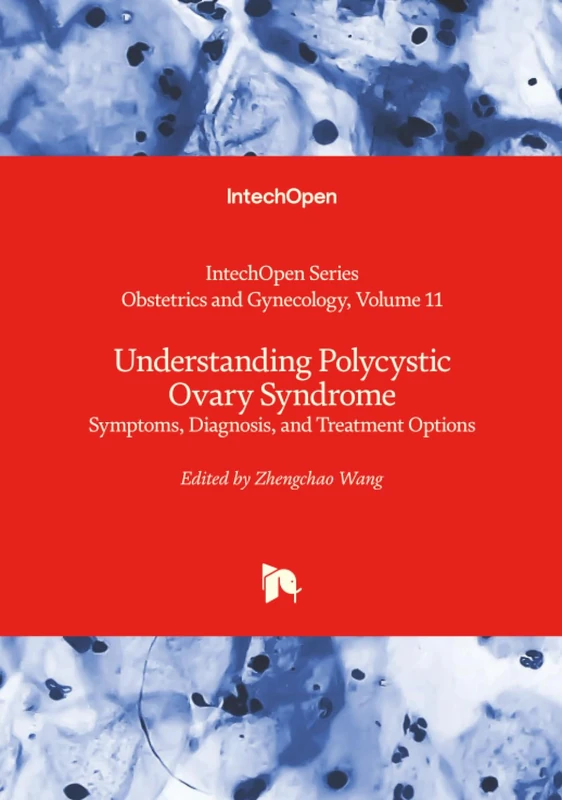 Understanding Polycystic Ovary Syndrome - Symptoms, Diagnosis, and Treatment Options (Obstetrics and Gynecology)