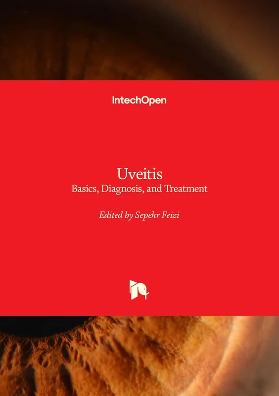 Uveitis - Basics, Diagnosis, and Treatment