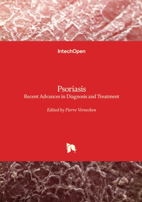 Psoriasis - Recent Advances in Diagnosis and Treatment