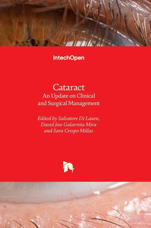 Cataract - An Update on Clinical and Surgical Management
