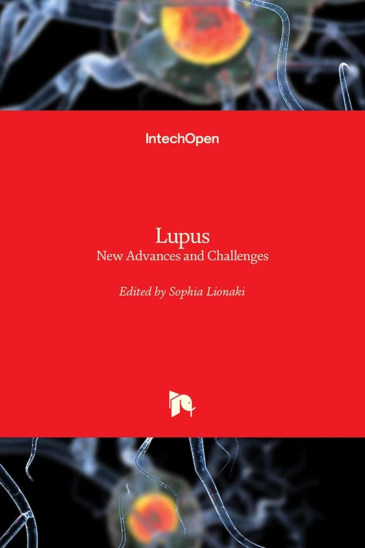 Lupus: New Advances and Challenges