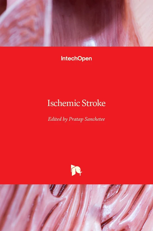 Ischemic Stroke - Image 1