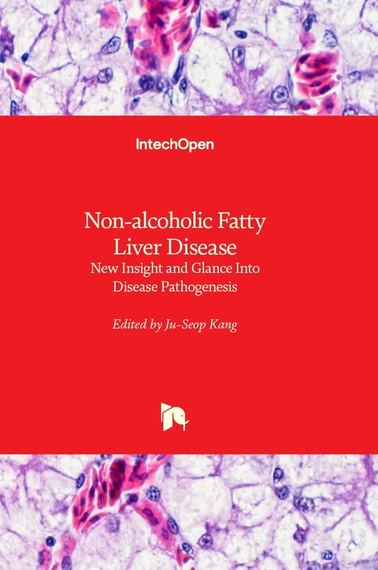 Non-alcoholic Fatty Liver Disease - New Insight and Glance Into Disease Pathogenesis