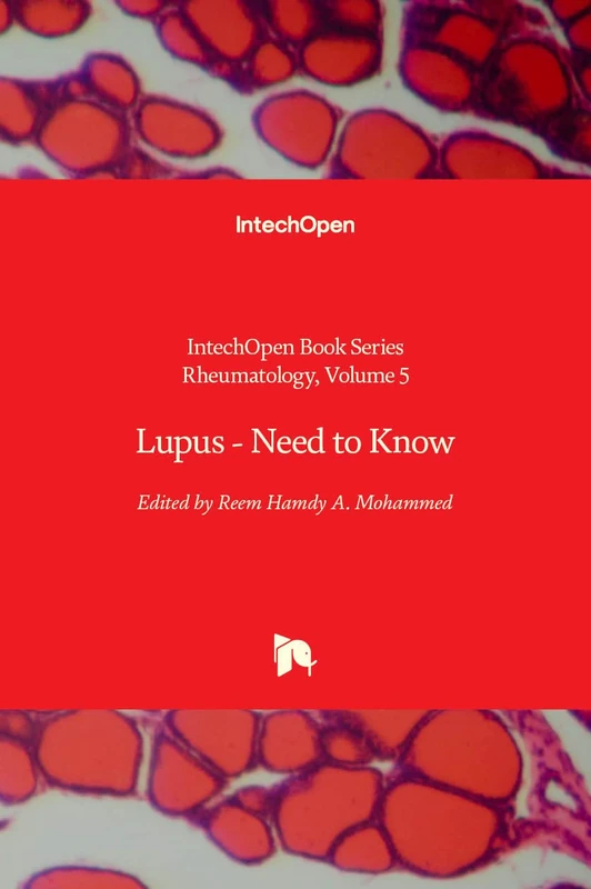 Lupus: Need to Know (Rheumatology, 5) - Image 1