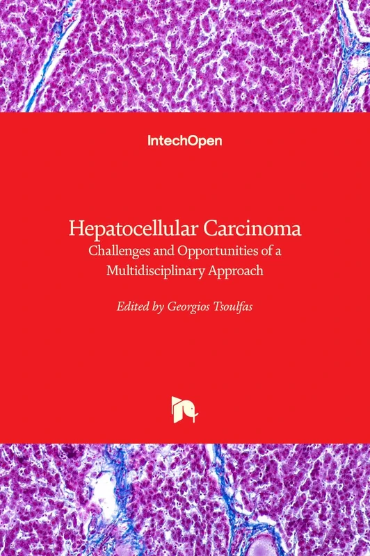 Hepatocellular Carcinoma: Challenges and Opportunities of a Multidisciplinary Approach