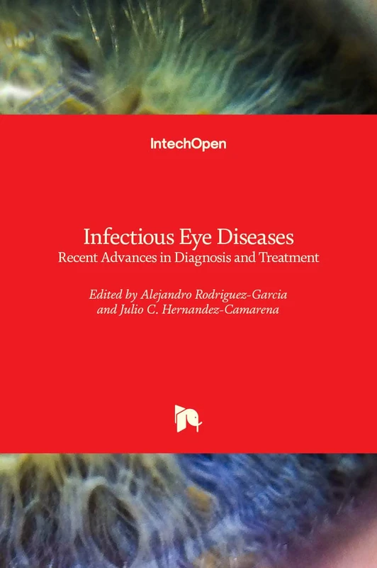 Infectious Eye Diseases: Recent Advances in Diagnosis and Treatment