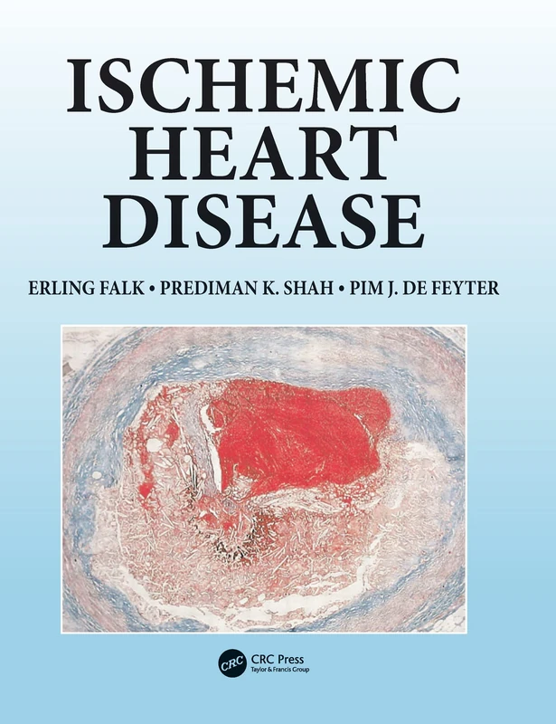 CRC Press Ischemic Heart Disease - Medical Management Guide