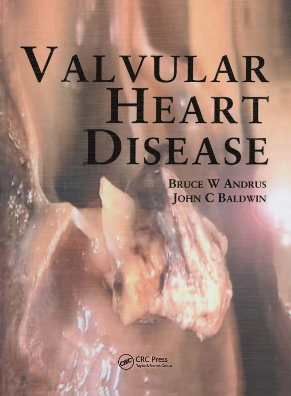 Valvular Heart Disease