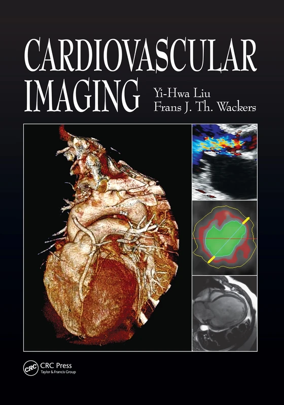 Cardiovascular Imaging