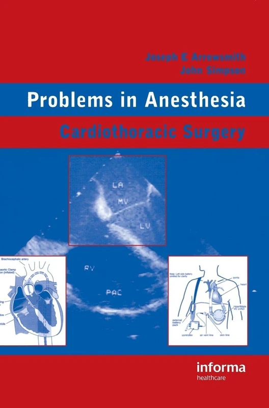 Cardiothoracic Surgery: Problems in Anesthesia