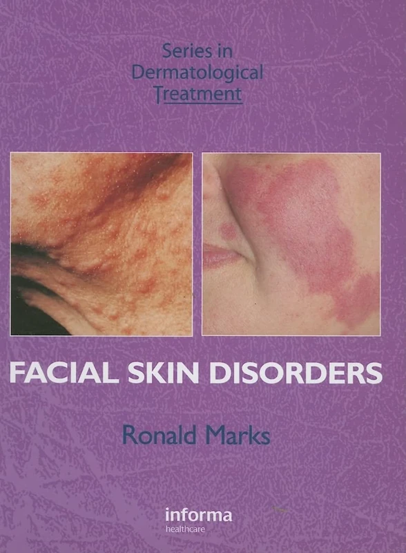 Facial Skin Disorders (Series in Dermatological Treatment)