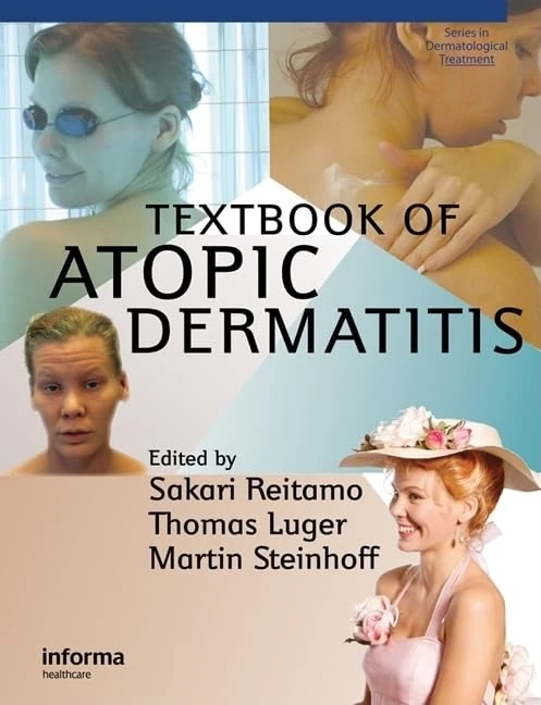 Textbook of Atopic Dermatitis (Series in Dermatological Treatment)