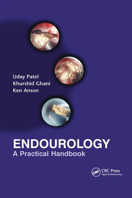 Endourology: A Practical Handbook