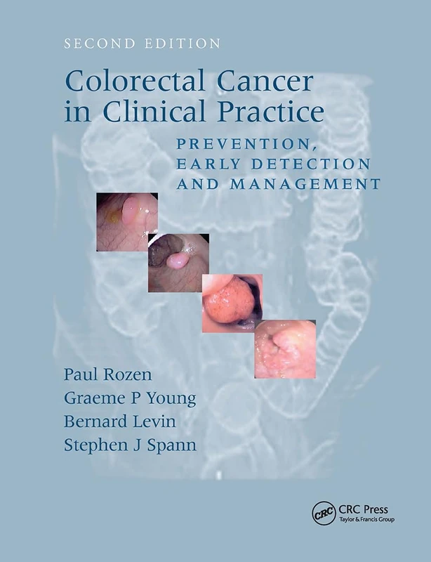 Colorectal Cancer in Clinical Practice: Prevention, Early Detection and Management, Second Edition