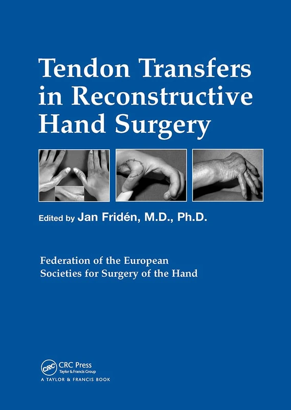 Tendon Transfers in Reconstructive Hand Surgery (Fessh Instructional Coursebooks)