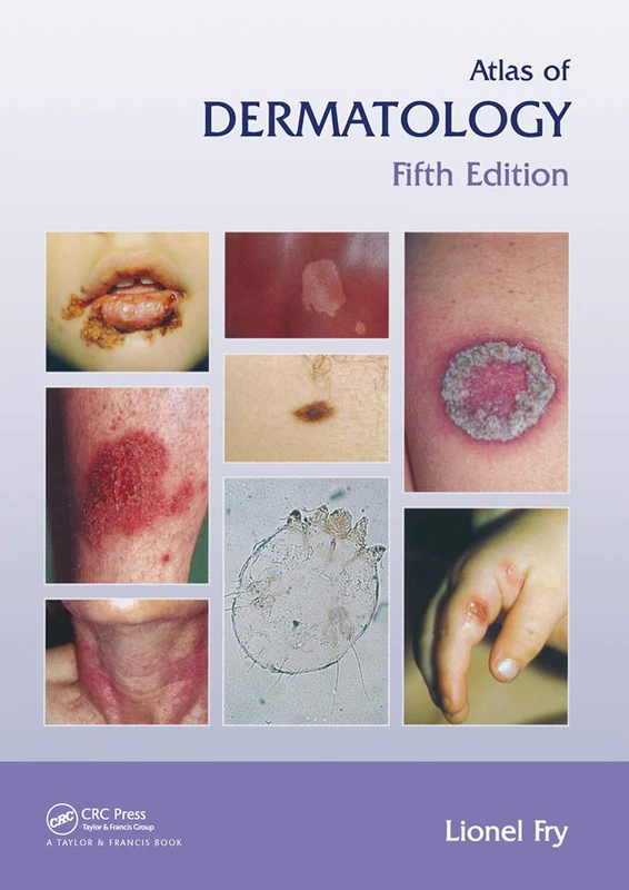 Atlas of Dermatology, Fifth Edition (Encyclopedia of Visual Medicine Series)