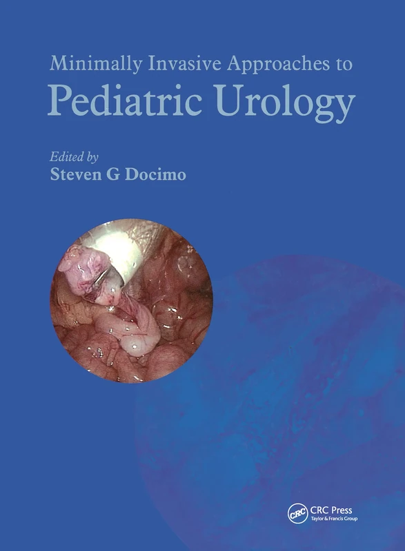 CRC Press Minimally Invasive Approaches to Pediatric Urology