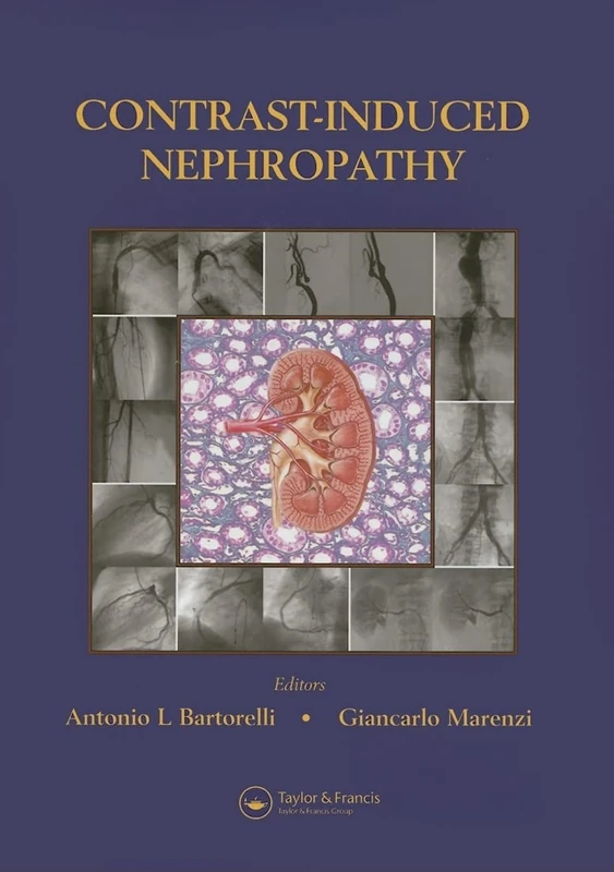 Contrast-Induced Nephropathy in Interventional Cardiovascular Medicine