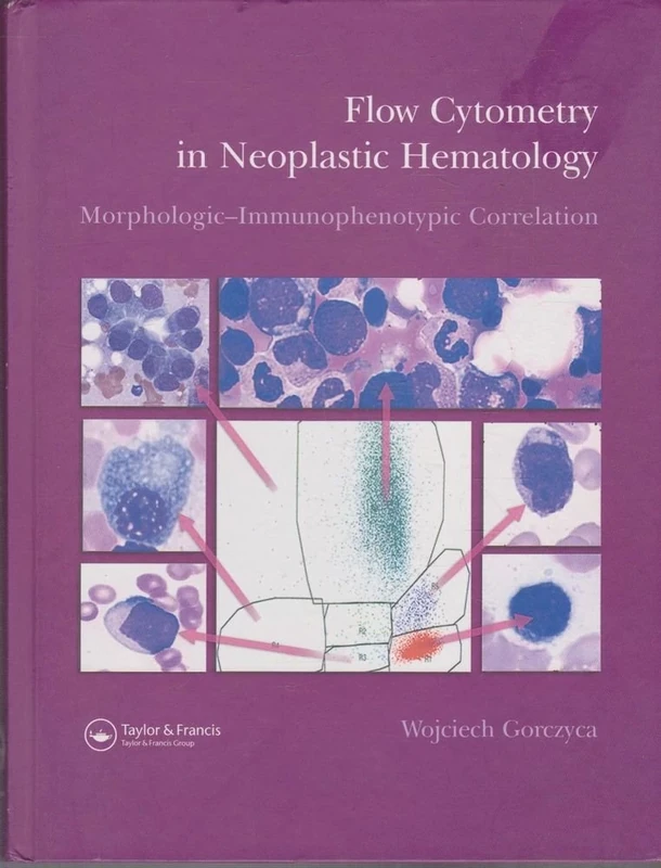 Flow Cytometry in Neoplastic Hematology: Morphologic--Immunophenotypic Correlation