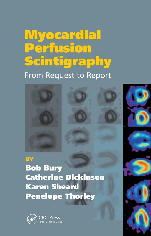 Myocardial Perfusion Scintigraphy: From Request to Report