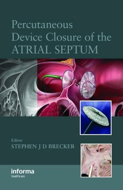 CRC Press - Percutaneous Device Closure of the Atrial Septum