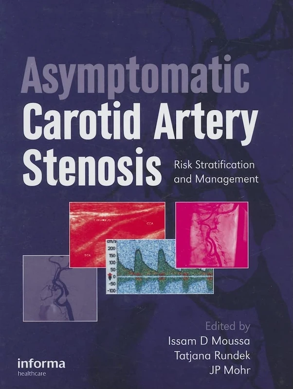 Asymptomatic Carotid Artery Stenosis: A Primer on Risk Stratification and Management