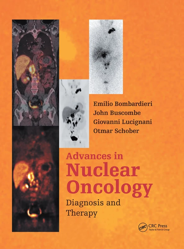 Advances in Nuclear Oncology: Diagnosis and Therapy