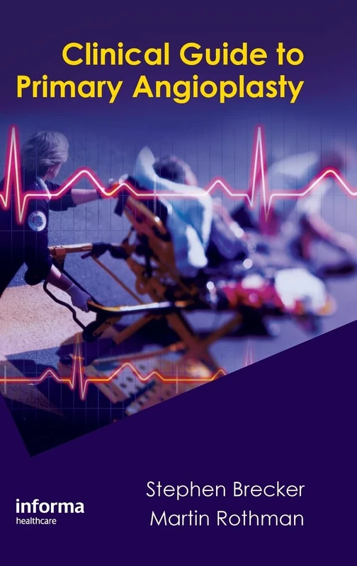 Clinical Guide to Primary Angioplasty