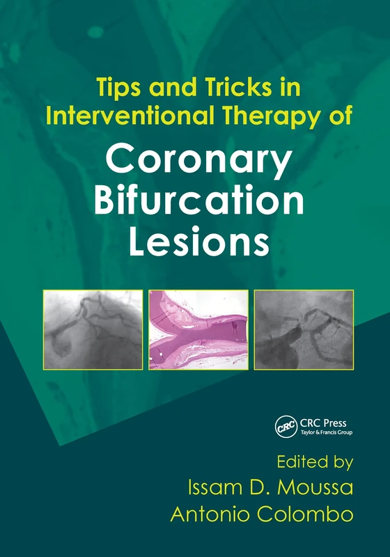 Tips and Tricks in Interventional Therapy of Coronary Bifurcation Lesions