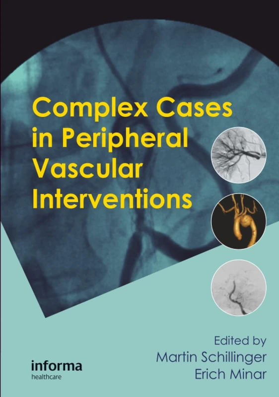 Complex Cases in Peripheral Vascular Interventions