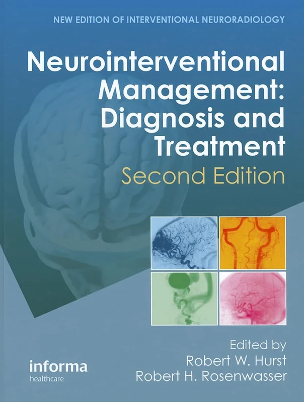 Neurointerventional Management: Diagnosis and Treatment