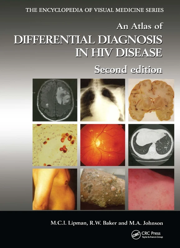 An Atlas of Differential Diagnosis in HIV Disease: 72 (Encyclopedia of Visual Medicine Series)