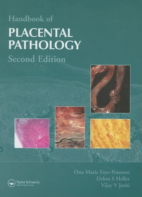 Handbook of Placental Pathology