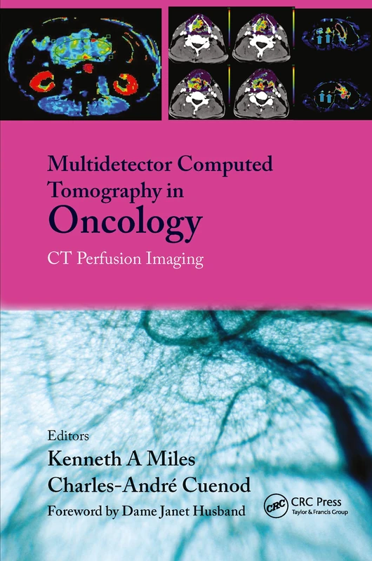 CRC Press - CT Perfusion Imaging in Oncology Text-Atlas