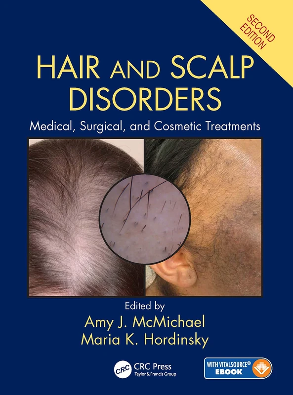 Hair and Scalp Disorders: Medical, Surgical, and Cosmetic Treatments, Second Edition