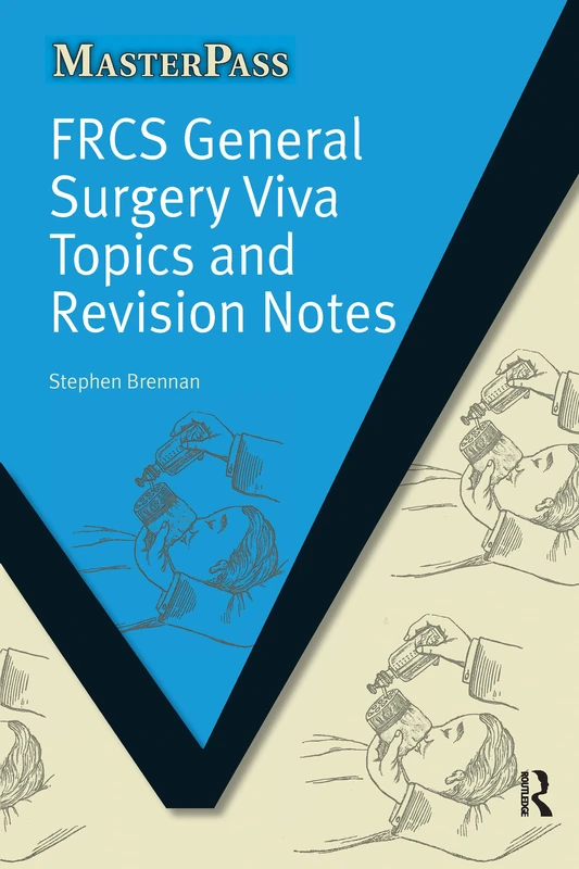 FRCS General Surgery Viva Topics and Revision Notes (MasterPass)