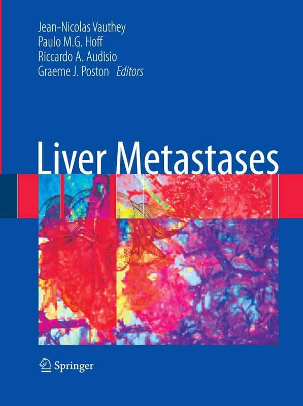Springer Liver Metastases - Multidisciplinary Management Book