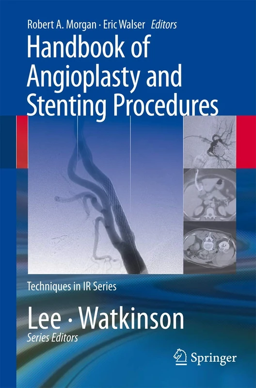 Handbook of Angioplasty and Stenting Procedures (Techniques in Interventional Radiology)