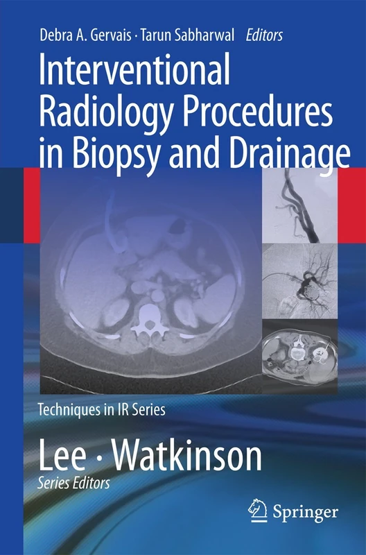 Interventional Radiology Procedures in Biopsy and Drainage (Techniques in Interventional Radiology)
