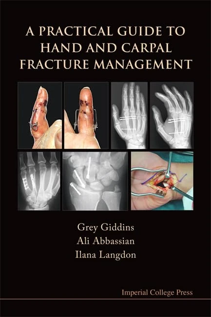 A PRACTICAL GUIDE TO HAND AND CARPAL FRACTURE MANAGEMENT