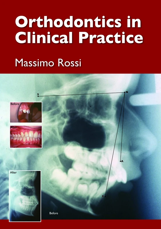 Orthodontics in Clinical Practice