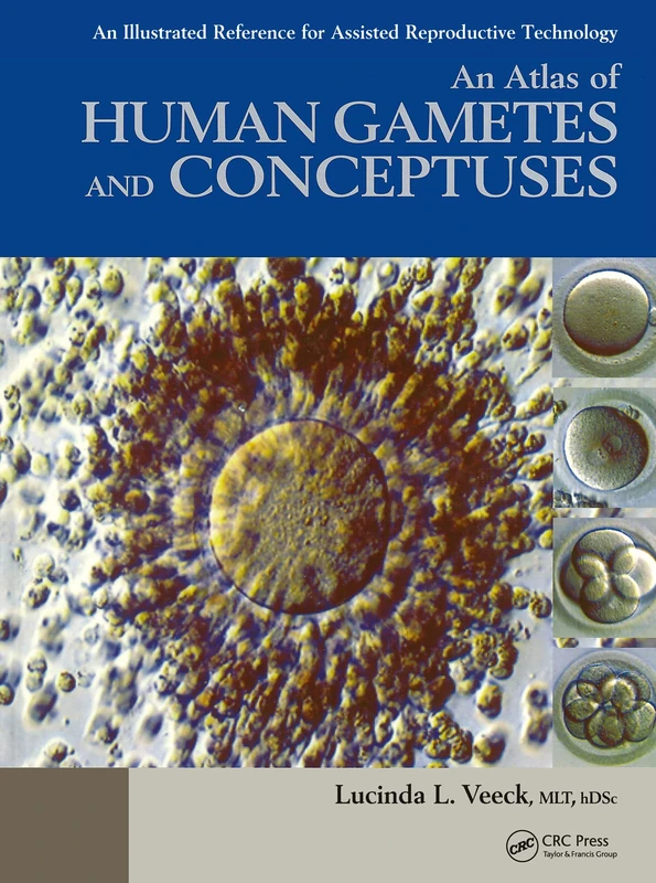 An Atlas of Human Gametes and Conceptuses: An Illustrated Reference for Assisted Reproductive Technology (BAR International)