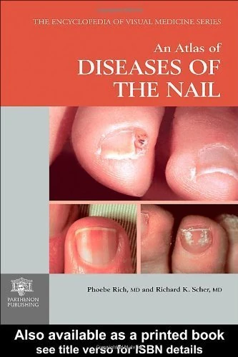 An Atlas of Diseases of the Nail: 61 (Encyclopedia of Visual Medicine Series)