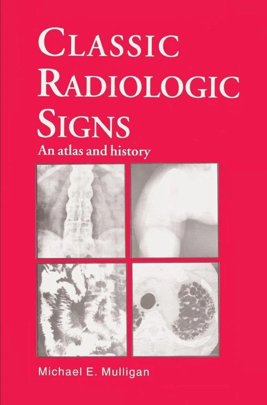 Classic Radiologic Signs: An Atlas and History