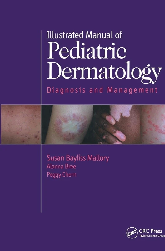 Illustrated Manual of Pediatric Dermatology: Diagnosis and Management