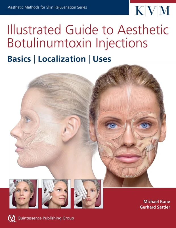 Illustrated Guide to Aesthetic Botulinum Toxin Injections (Aesthetic Methods for Skin Rejuvenation)