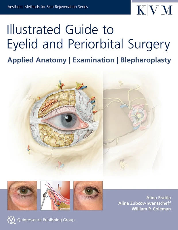 Illustrated Guide to Eyelid and Periorbital Surgery: Applied Anatomy,Examination, Blepharoplasty (Aesthetic Methods for Skin Rejuvenation Series)