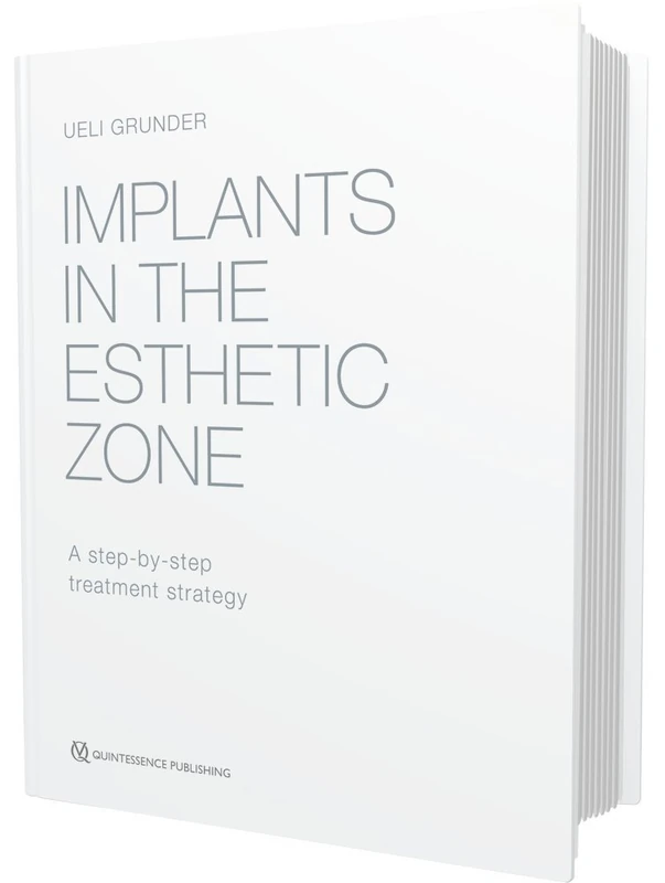 Implants in the Esthetic Zone: A Step-by-Step Treatment Strategy