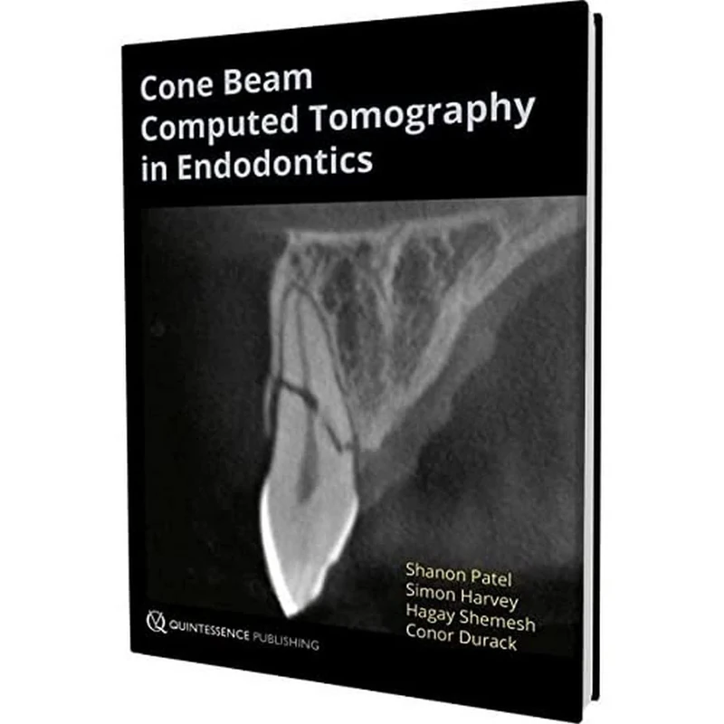 Cone Beam Computed Tomography in Endodontics